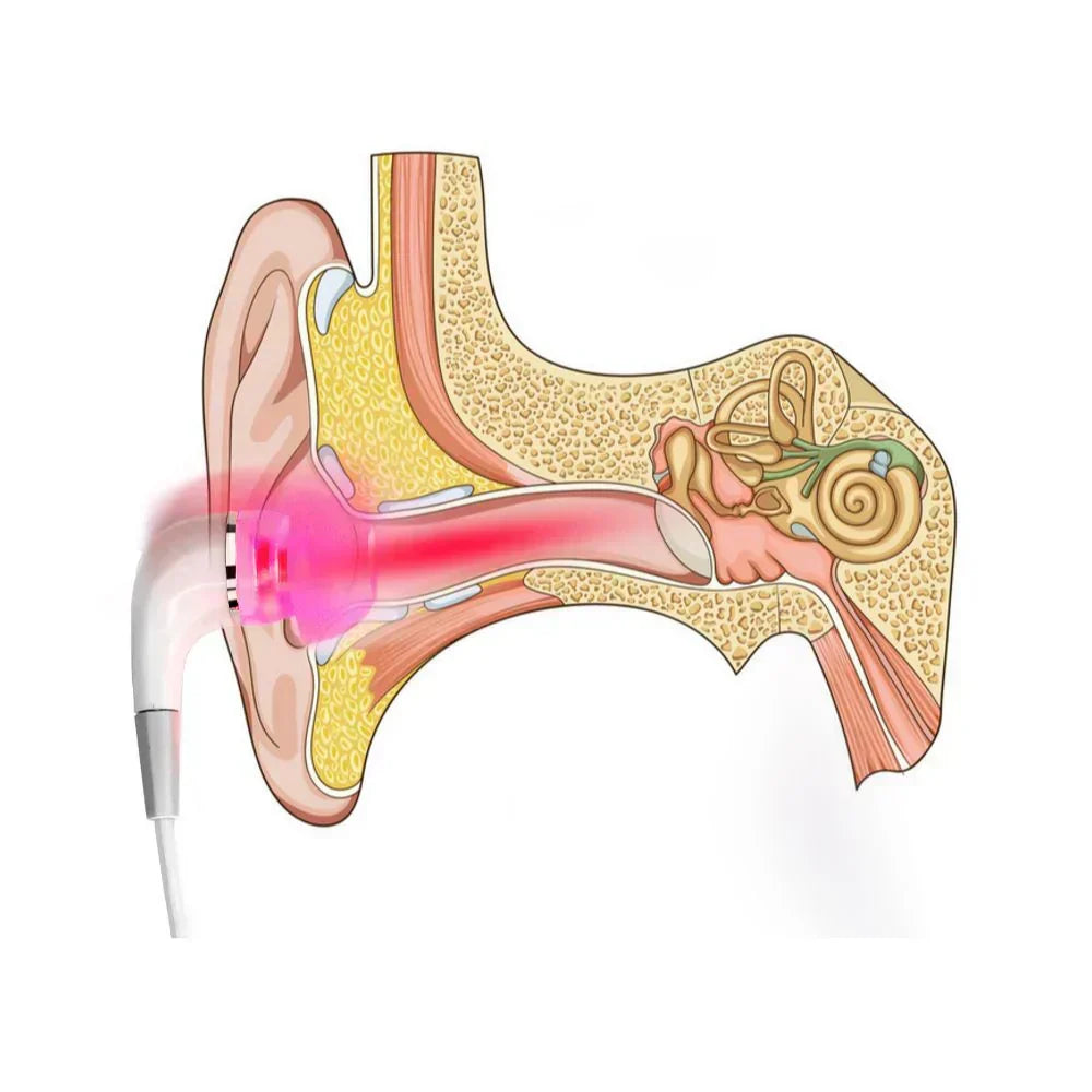 Tinnitus Relief Sound Therapy Earplugs β Comfortable Earplugs for Calm and Relaxation
