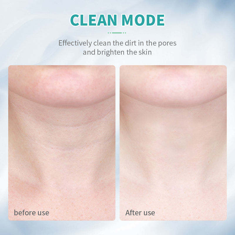 LED Facial Massager Face And Neck Lift Device Anti-Aging Skin Tightening Tool